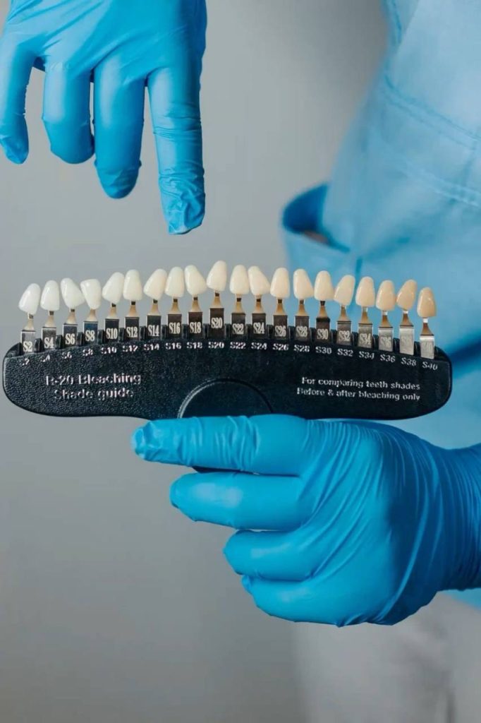 انتخاب رنگ کامپوزیت