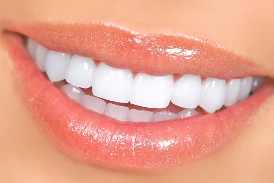 تغییر رنگ کامپوزیت دندان