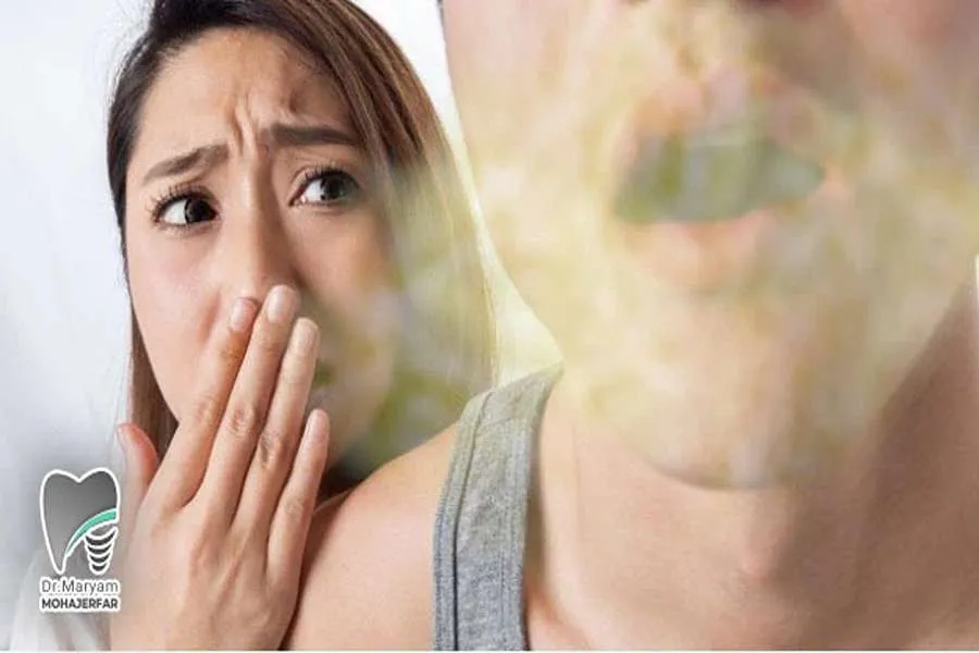 بوی بد دهان و کامپوزیت