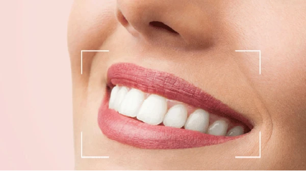 آنالیز لبخند دیجیتال