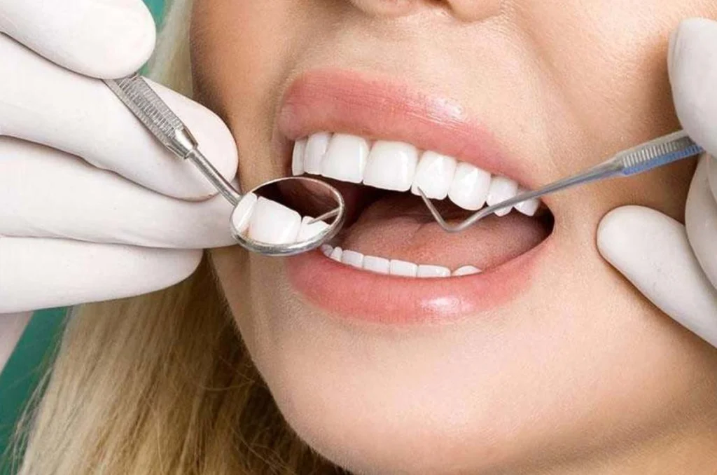 ماندگاری کامپوزیت ونیر