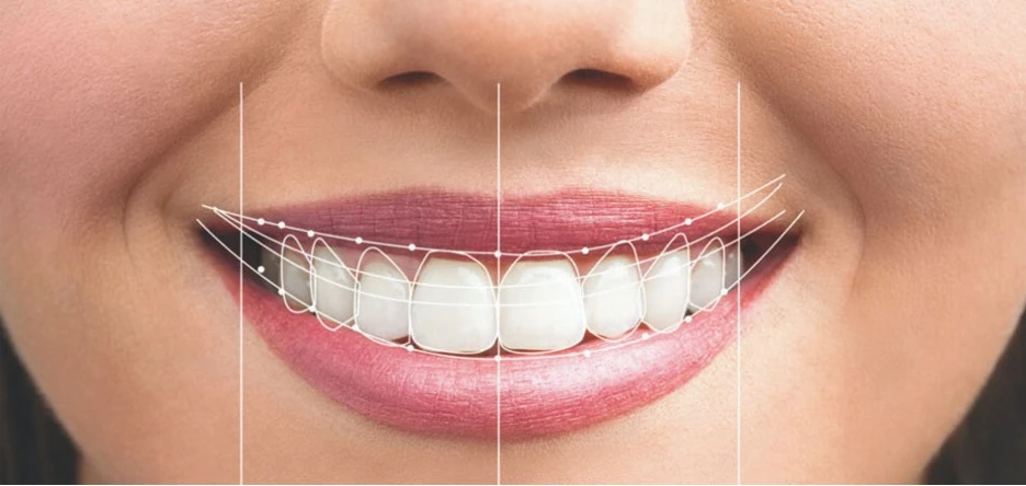آنالیز لبخند دیجیتال