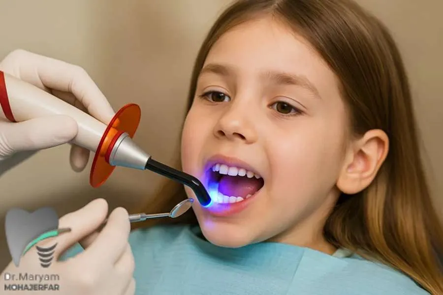 ترمیم دندان شیری با کامپوزیت