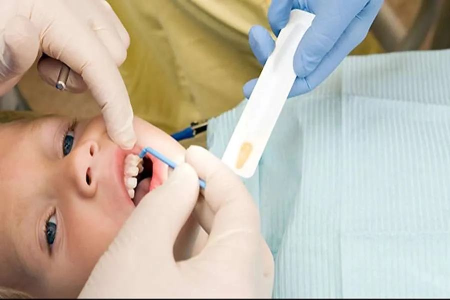 فلورایدتراپی