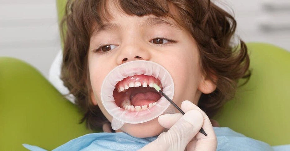 فلورایدتراپی