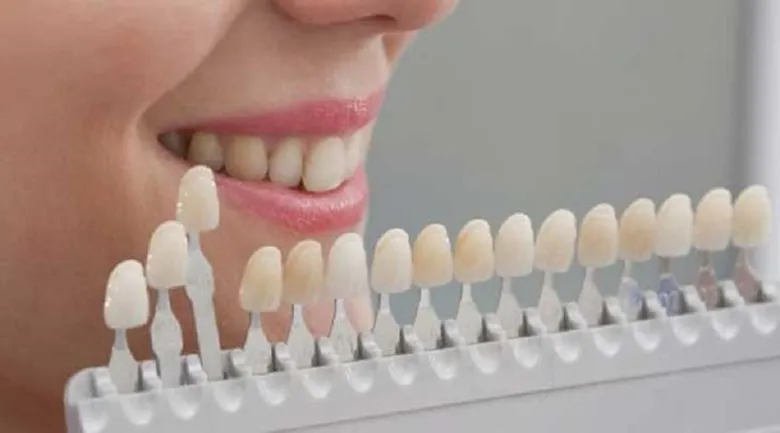 انتخاب درست لمینت