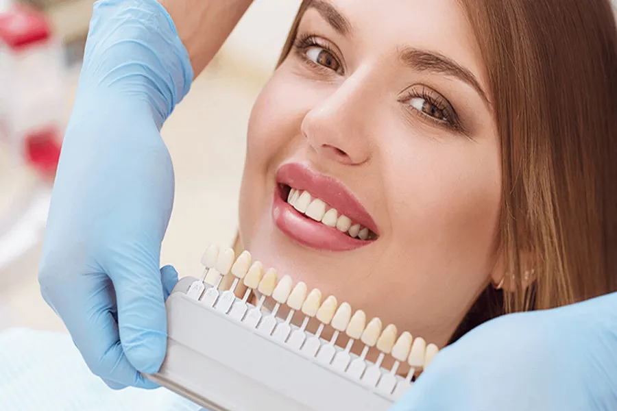 لمینت هالیوودی