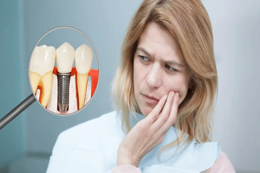 کاهش درد ایمپلنت دندان