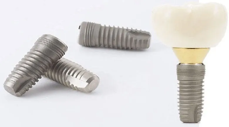 تست اولیه ایمپلنت