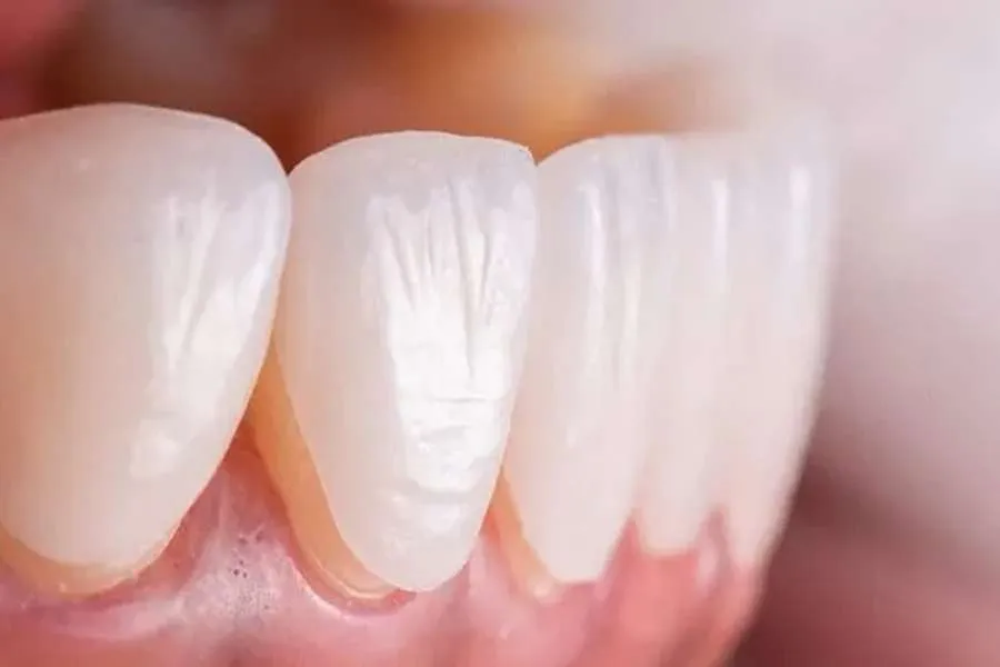 لمینت ایمکس